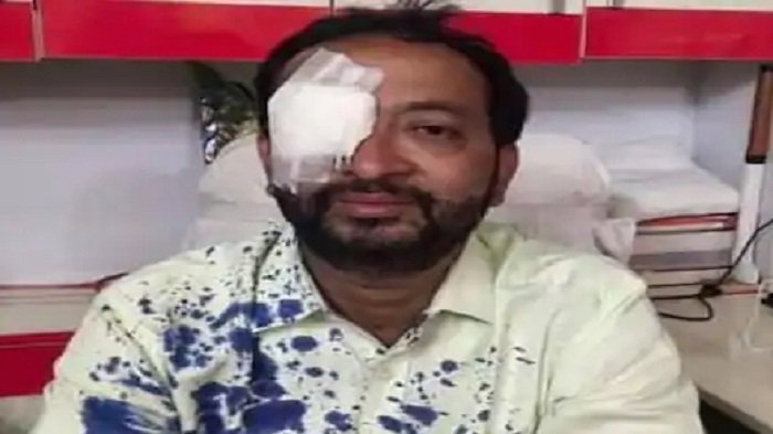 सीवान में प्लूरल्स पार्टी के प्रत्याशी पर जानलेवा हमला, आंख क्षतिग्रस्‍त 3