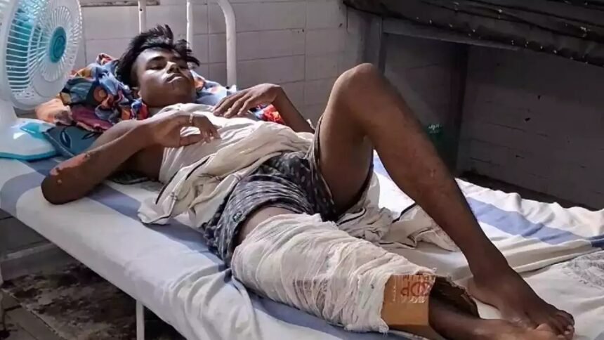 बिहार के बड़े अस्पताल में घोर लापरवाही, टूटे हुए पैर में डॉक्टरों ने प्लास्टर की जगह लगा दिया कार्टन 1