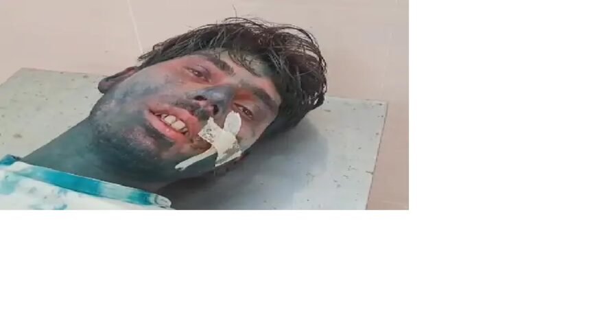 होली की टोली में शामिल नहीं करने पर 20 लोगों ने किया हमला, एक को लगी गोली मार पीट और फायरिंग में 2 अन्य घायल 1
