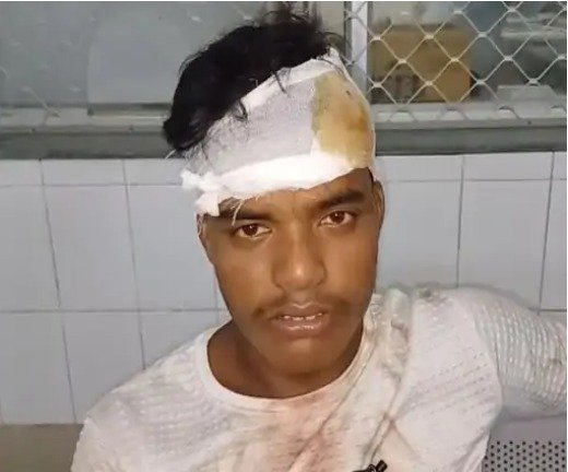 चाट दुकान पर मारपीट, 5 घायल 1